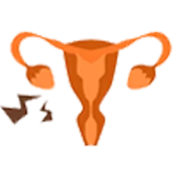 Ovulation Disorder